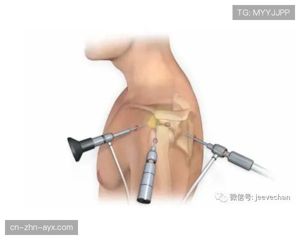 肩膀习惯性脱臼后睡觉不敢翻身，肩膀脱臼躺着好还是吊着好
